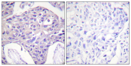 FoxO1/3/4 Rabbit Polyclonal Antibody