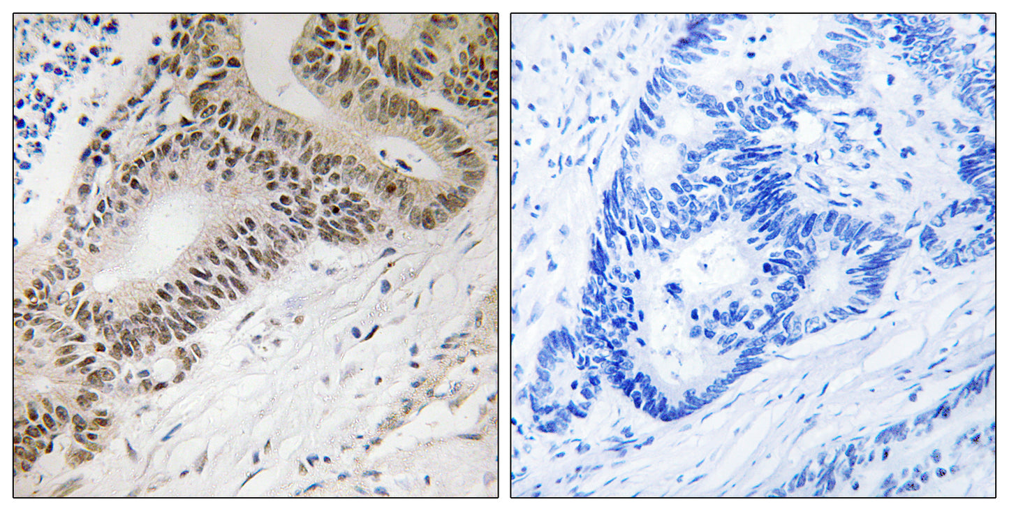 FoxO3A Rabbit Polyclonal Antibody