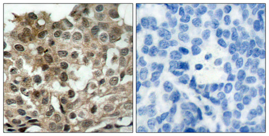 FoxO3A Rabbit Polyclonal Antibody