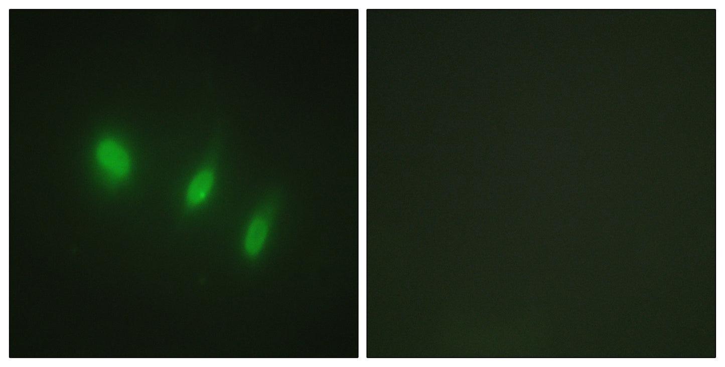 FoxO4 Rabbit Polyclonal Antibody