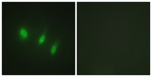 FoxO4 Rabbit Polyclonal Antibody