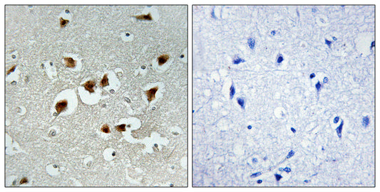FoxO4 Rabbit Polyclonal Antibody