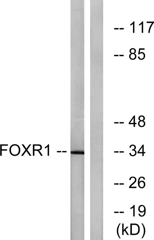 FoxR1 Rabbit Polyclonal Antibody