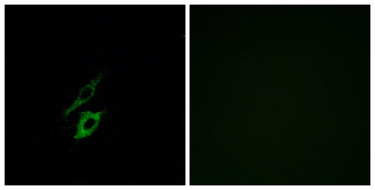 FPR1 Rabbit Polyclonal Antibody