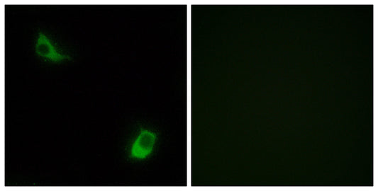 FPRL2 Rabbit Polyclonal Antibody