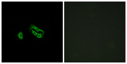 FPRL2 Rabbit Polyclonal Antibody