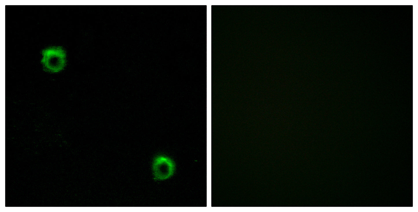 Frizzled-2 Rabbit Polyclonal Antibody