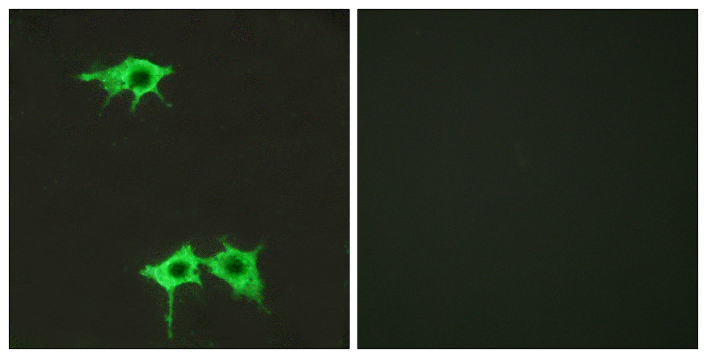 Frizzled-4 Rabbit Polyclonal Antibody