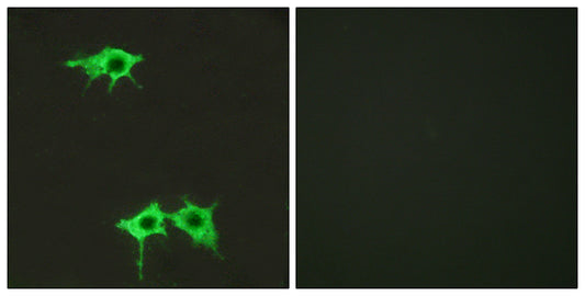 Frizzled-4 Rabbit Polyclonal Antibody