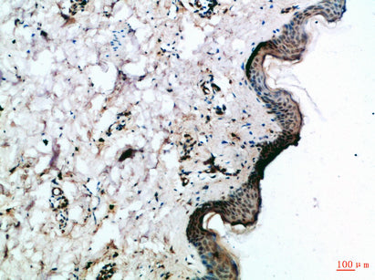 Frizzled-4 Rabbit Polyclonal Antibody