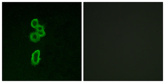 Frizzled-6 Rabbit Polyclonal Antibody