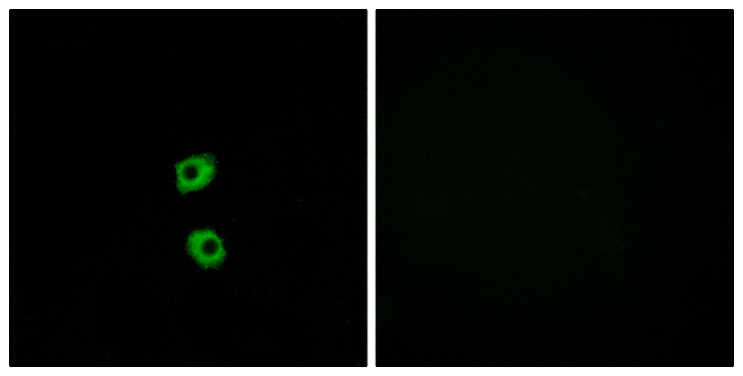 Frizzled-7 Rabbit Polyclonal Antibody