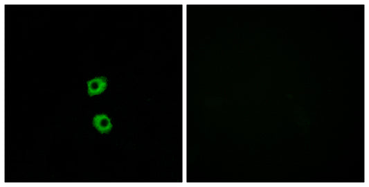 Frizzled-7 Rabbit Polyclonal Antibody