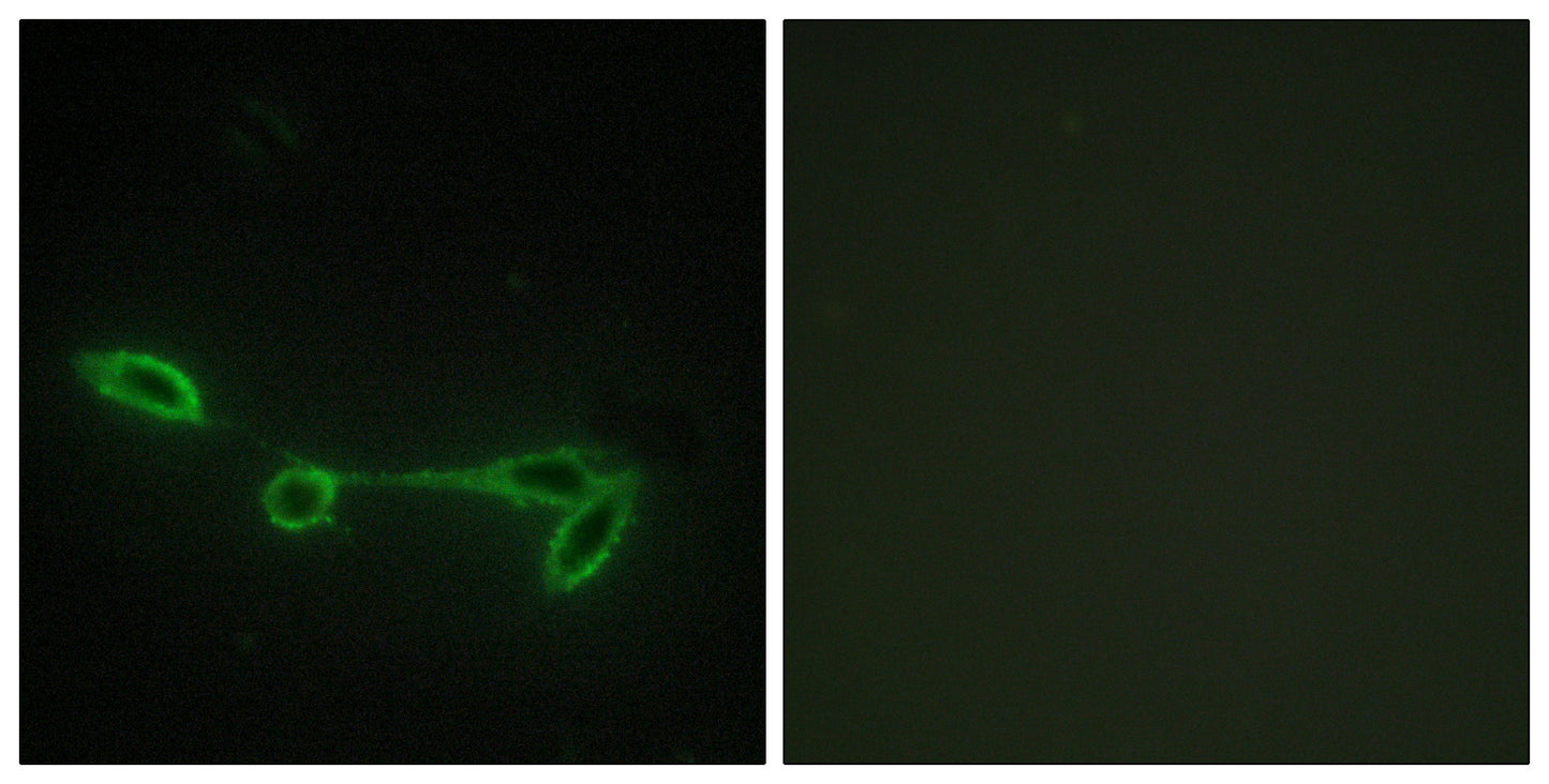 Fucokinase Rabbit Polyclonal Antibody