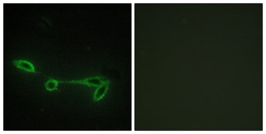Fucokinase Rabbit Polyclonal Antibody