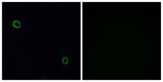 Fusin Rabbit Polyclonal Antibody