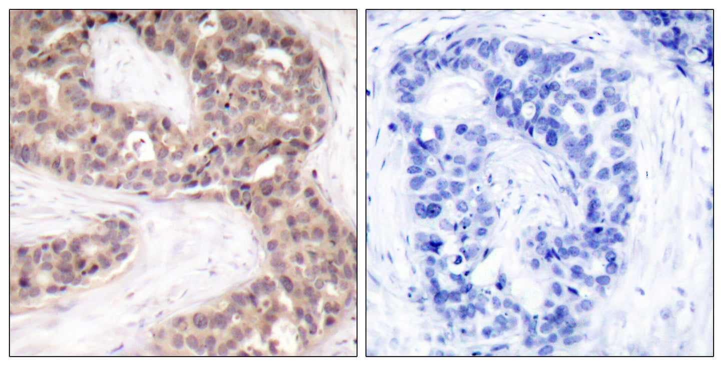 G3BP1 Rabbit Polyclonal Antibody