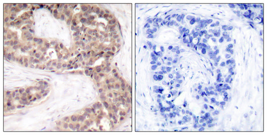 G3BP1 Rabbit Polyclonal Antibody