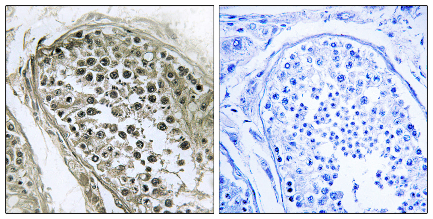 Gab 2/4 Rabbit Polyclonal Antibody
