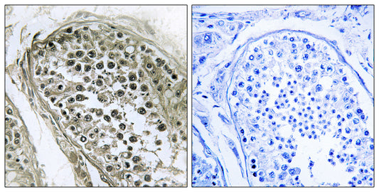 Gab 2/4 Rabbit Polyclonal Antibody