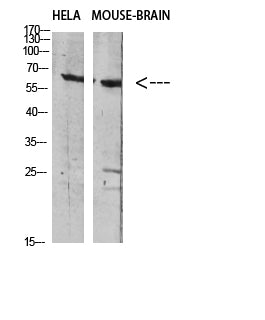 GABA T-1 Rabbit Polyclonal Antibody