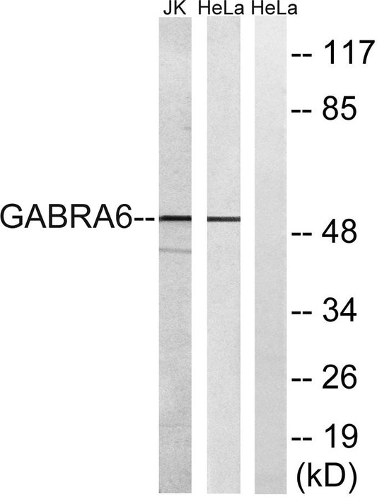 GABAA Rα6 Rabbit Polyclonal Antibody