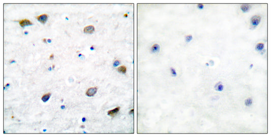 GABAA Rβ1 Rabbit Polyclonal Antibody