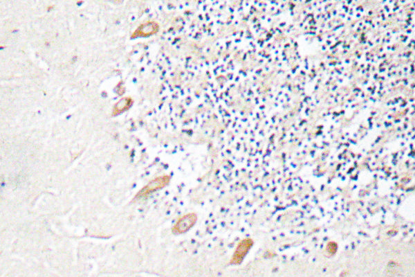 GABAA Rβ2 Rabbit Polyclonal Antibody