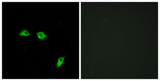 GABAB R1 Rabbit Polyclonal Antibody