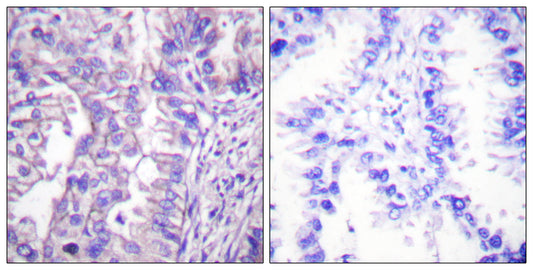 GAD-65/67 Rabbit Polyclonal Antibody