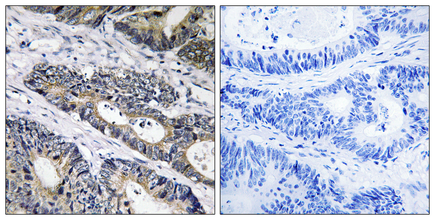 Galactosidase β1L3 Rabbit Polyclonal Antibody