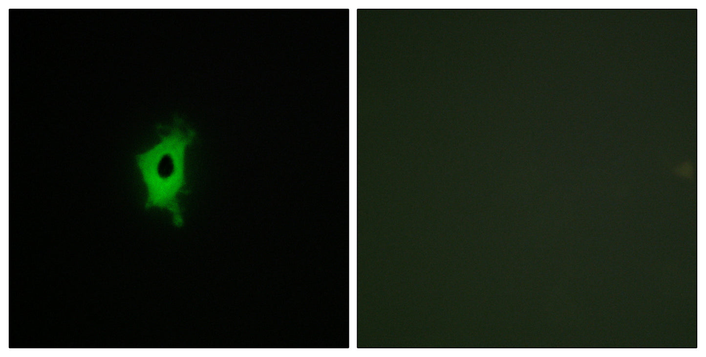 Galectin-2 Rabbit Polyclonal Antibody