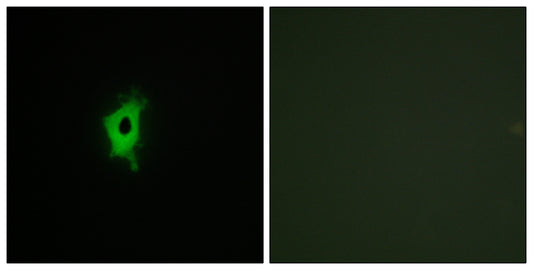 Galectin-2 Rabbit Polyclonal Antibody