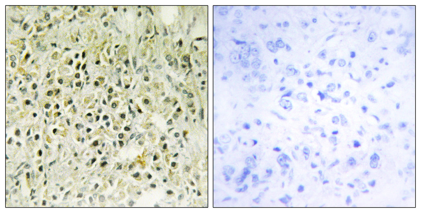 Galectin-8 Rabbit Polyclonal Antibody