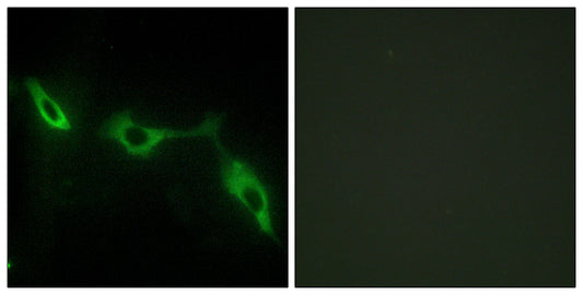 Galectin-9 Rabbit Polyclonal Antibody