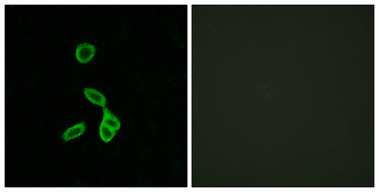 GALR1 Rabbit Polyclonal Antibody