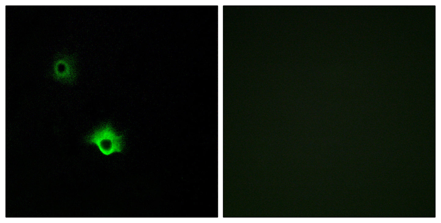 GALR3 Rabbit Polyclonal Antibody