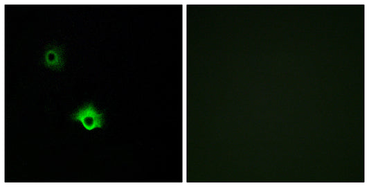 GALR3 Rabbit Polyclonal Antibody