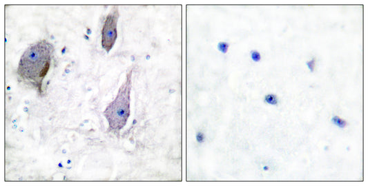 GAS3 Rabbit Polyclonal Antibody