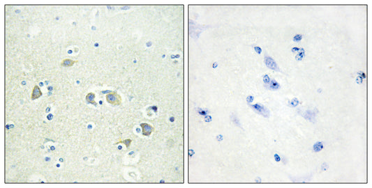 Gas6 Rabbit Polyclonal Antibody