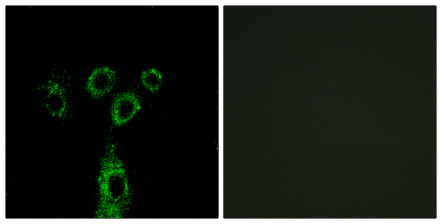GASP-1 Rabbit Polyclonal Antibody