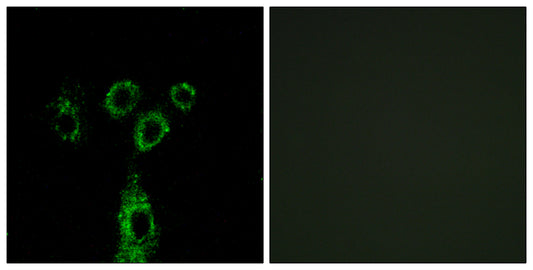 GASP-1 Rabbit Polyclonal Antibody