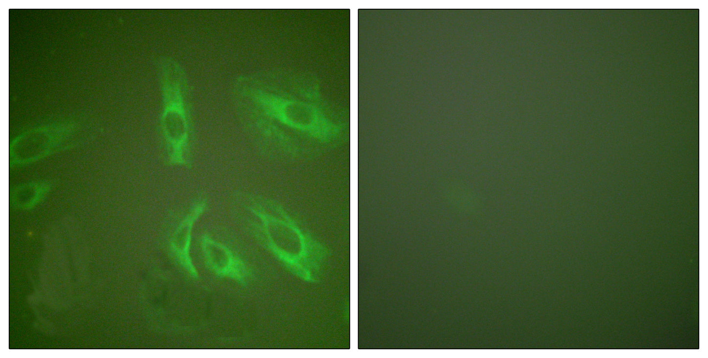 Gastrin Rabbit Polyclonal Antibody