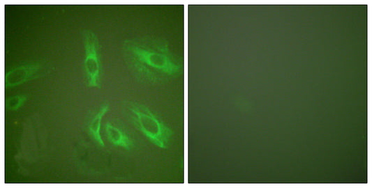 Gastrin Rabbit Polyclonal Antibody