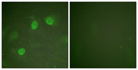 GATA-2/3 Rabbit Polyclonal Antibody