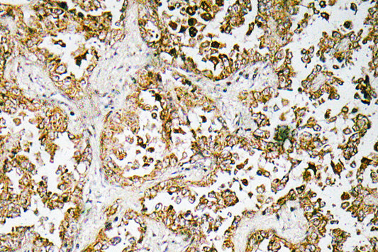 GATA-5 Rabbit Polyclonal Antibody