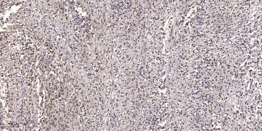 GBP5 Rabbit Polyclonal Antibody