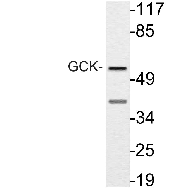 GCK Rabbit Polyclonal Antibody