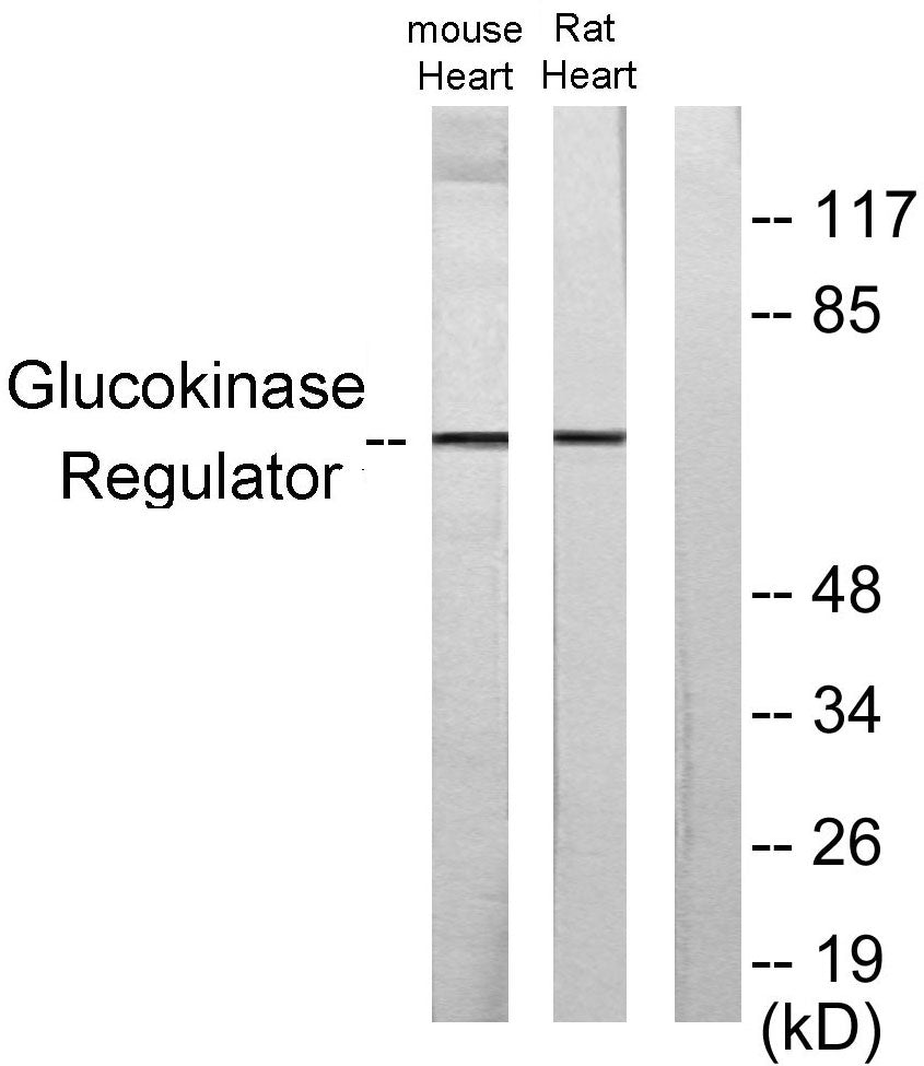 GCKR Rabbit Polyclonal Antibody