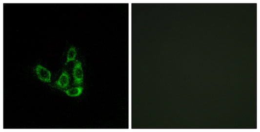 GCNT3 Rabbit Polyclonal Antibody